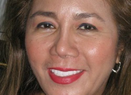 Englewood Dental Implant After Patient 2